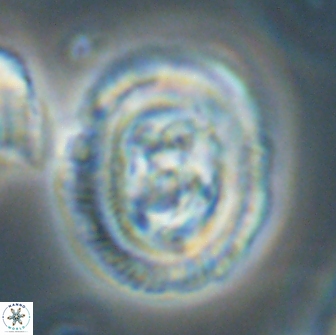 Chiasmolithus edentulus 66882