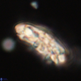 Chiasmolithus edentulus 66896