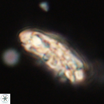 Chiasmolithus edentulus 66896
