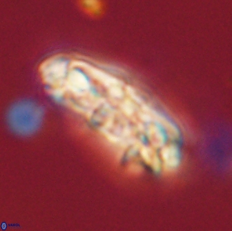 Chiasmolithus edentulus 66897