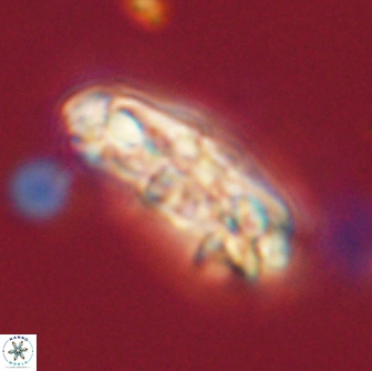 Chiasmolithus edentulus 66897