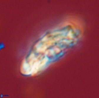 Chiasmolithus edentulus 66898