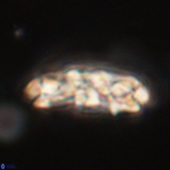 Chiasmolithus edentulus 66900