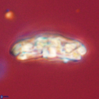 Chiasmolithus edentulus 66903