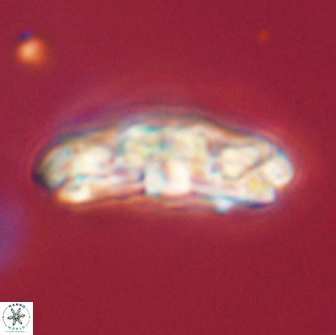 Chiasmolithus edentulus 66903