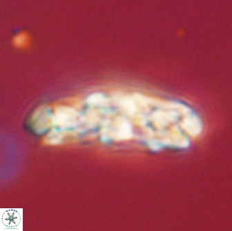 Chiasmolithus edentulus 66905