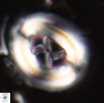 Chiasmolithus edentulus 20091