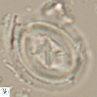 Chiasmolithus edentulus 20092