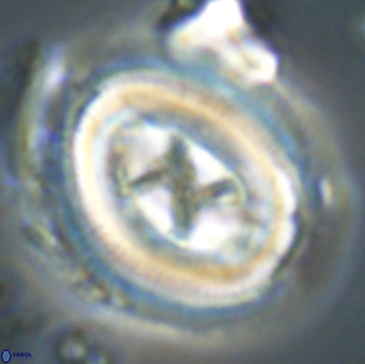 Chiasmolithus edentulus 20093