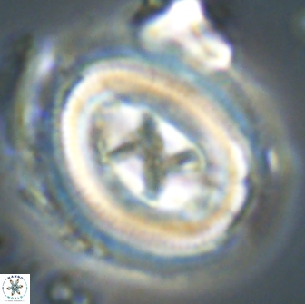 Chiasmolithus edentulus 20093