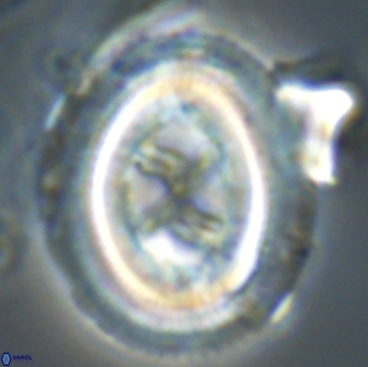 Chiasmolithus edentulus 20094