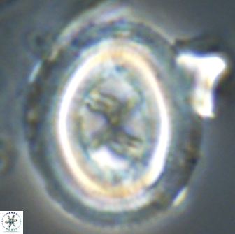 Chiasmolithus edentulus 20094