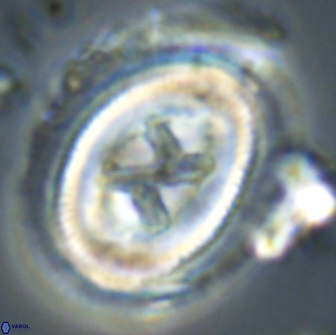 Chiasmolithus edentulus 20095