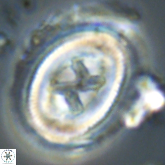 Chiasmolithus edentulus 20095