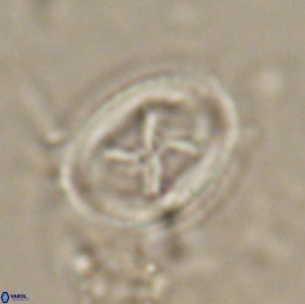 Chiasmolithus edentulus 20004