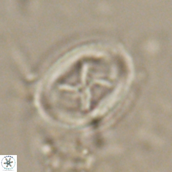 Chiasmolithus edentulus 20004