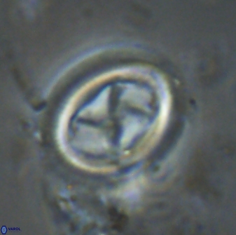 Chiasmolithus edentulus 20006