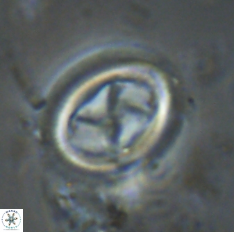 Chiasmolithus edentulus 20006