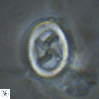 Chiasmolithus edentulus 20007