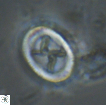Chiasmolithus edentulus 20008
