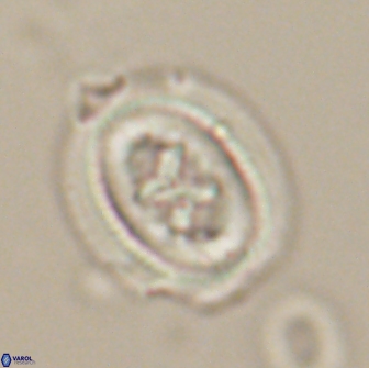 Chiasmolithus edentulus 20150