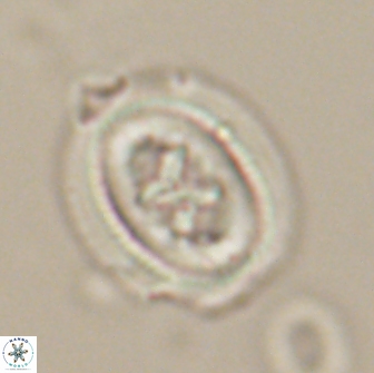 Chiasmolithus edentulus 20150