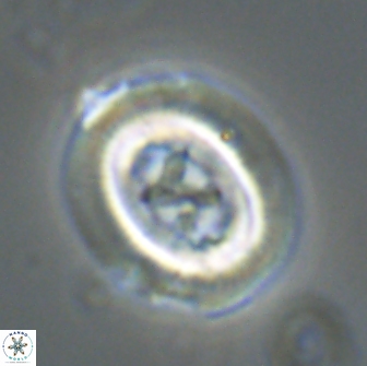 Chiasmolithus edentulus 20151