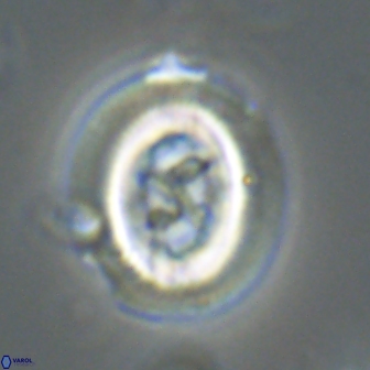 Chiasmolithus edentulus 20152