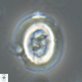 Chiasmolithus edentulus 20152