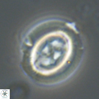 Chiasmolithus edentulus 20153