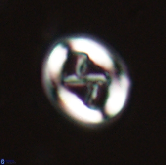 Chiasmolithus edentulus 20189