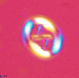 Chiasmolithus edentulus 20190