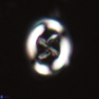 Chiasmolithus edentulus 20192