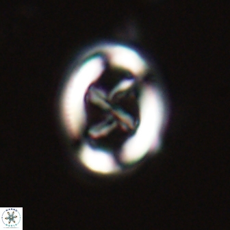 Chiasmolithus edentulus 20192