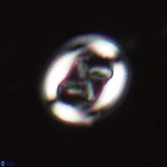 Chiasmolithus edentulus 20193