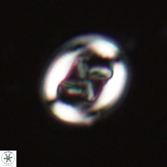 Chiasmolithus edentulus 20193