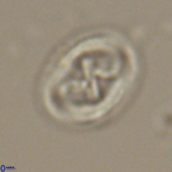 Chiasmolithus edentulus 20195