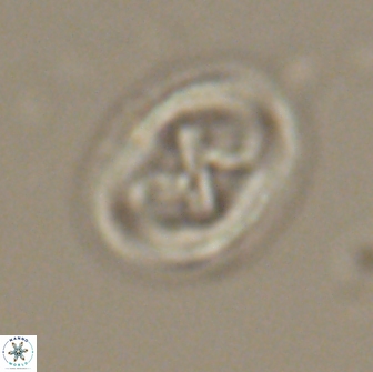 Chiasmolithus edentulus 20195