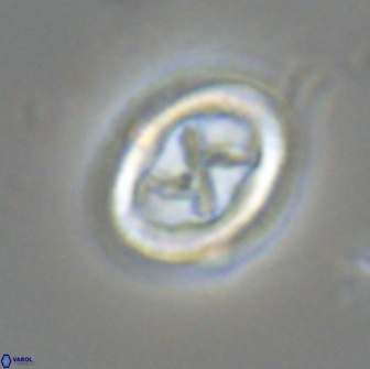 Chiasmolithus edentulus 20196