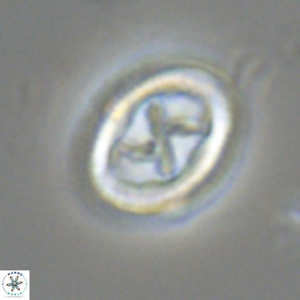 Chiasmolithus edentulus 20196