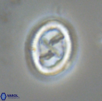 Chiasmolithus edentulus 20197