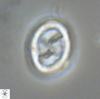Chiasmolithus edentulus 20197