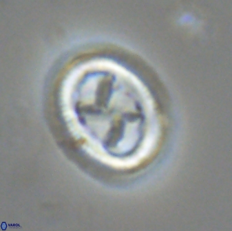 Chiasmolithus edentulus 20198