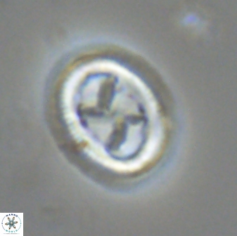 Chiasmolithus edentulus 20198