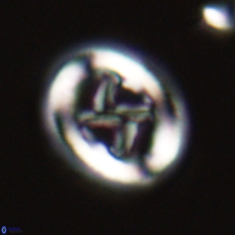 Chiasmolithus edentulus 20271