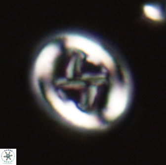 Chiasmolithus edentulus 20271