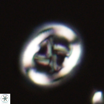 Chiasmolithus edentulus 20275