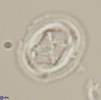 Chiasmolithus edentulus 20276