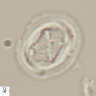 Chiasmolithus edentulus 20276