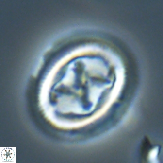 Chiasmolithus edentulus 20278